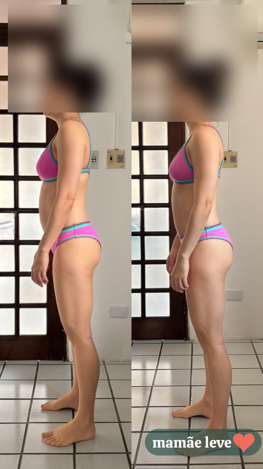 Antes e depois de Jéssica de lado, rosto preservado por privacidade