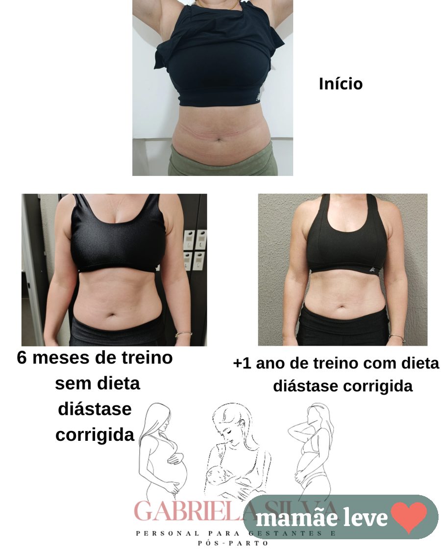 Evolução de aluna: início, 6 meses de treino sem dieta com diástase corrigida, e mais 1 ano de treino com dieta