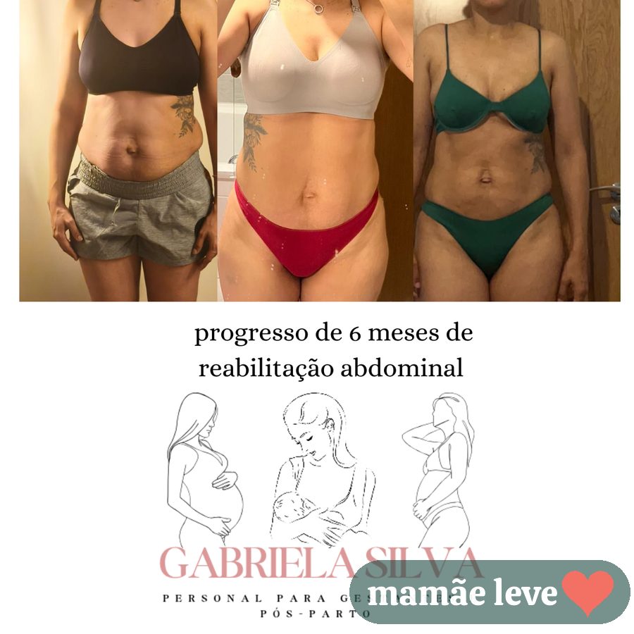 Progresso de 6 meses de reabilitação abdominal em três registros